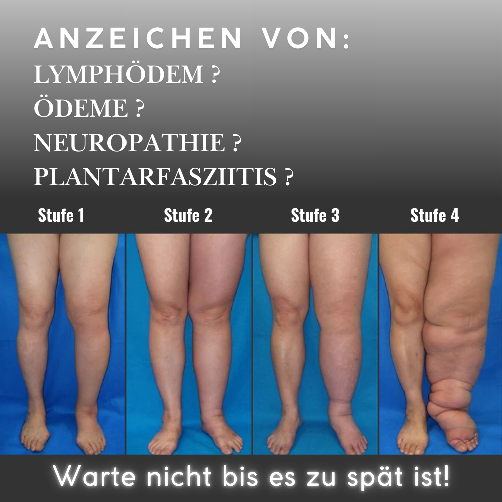 LegVital - leichte Beine durch ärztliche Massage