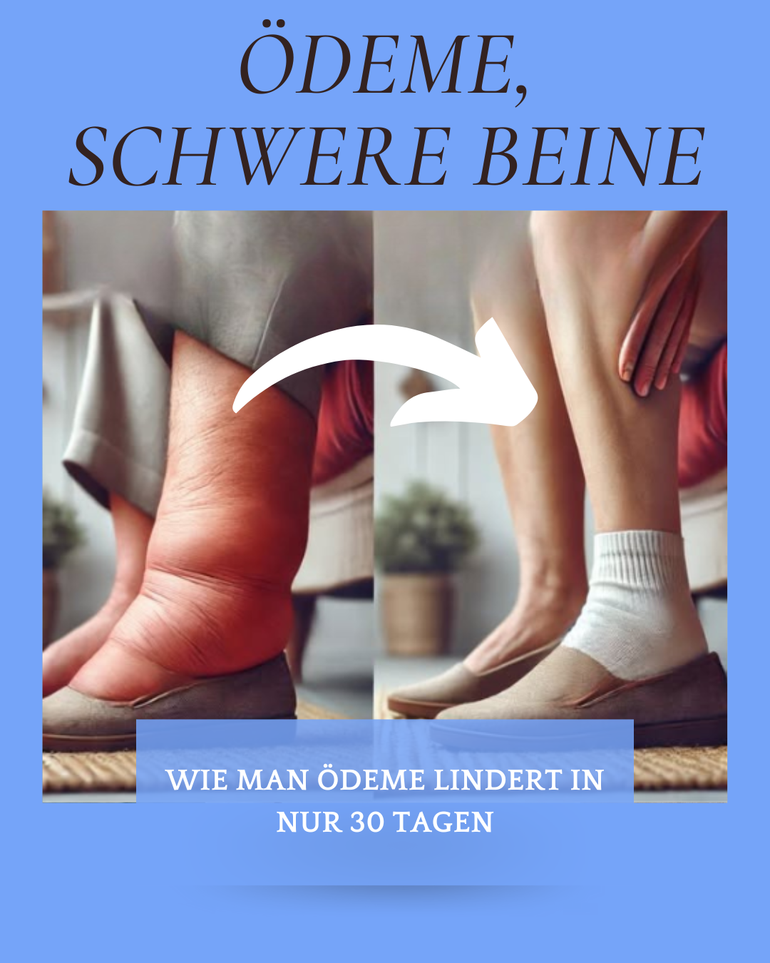 LegVital - leichte Beine durch ärztliche Massage